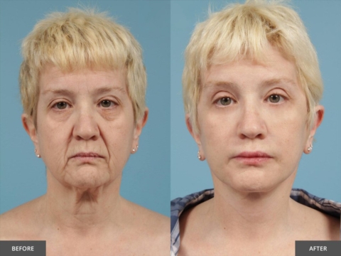 Instant face Tightener No-Filter Primer (with Brush FREE !)